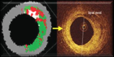 Sawada et al, EHJ (2008) 29, 1136 1146