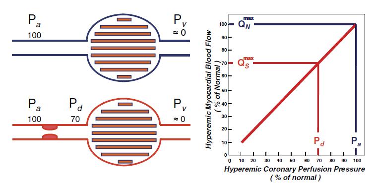 Όταν δεν υπάρχει στένωση δεν υπάρχει διαφορά πίεσης στην πορεία της επικαρδιακής αρτηρίας, ενώ όταν υπάρχει στένωση σηµειώνεται πτώση πίεσης µετά τη στένωση Μικροκυκλοφορία Η πίεση αυτή (και εποµένως