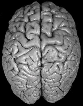 Διάφορες όψεις του εγκεφάλου Ρυγχιαία Ραχιαία όψη των ηµισφαιρίων 2 1 3 1 3 2 1. Μετωπιαίος 2. Βρεγµατικός 3. Ινιακός 4. Κεντρική αύλακα 5.