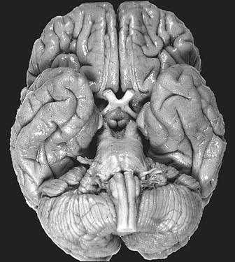 Διάφορες όψεις του εγκεφάλου Κοιλιακή όψη των ηµισφαιρίων 1 1 2 3 4 6 5 8 7 9 1. Οσφρητικός βολβός 2. Οπτικό νεύρο 3. Οπτικό χίασµα 4. Γέφυρα 5. Προµήκης µυελός 6.