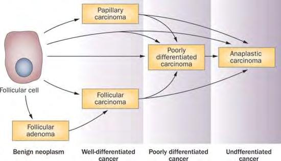 Εικόνα 4: Σχέδιο της υποτιθέμενης αποδιαφοροποίησης των όγκων του θυρεοειδούς που προέρχεται από θυλακιώδη κύτταρα του θυρεοειδούς (Nikiforov & Nikiforova, 2011).