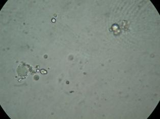 Φωτογραφίες από μικροσκόπιο γαλακτωμάτων που παρασκευάζονται
