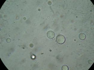 Φωτογραφίες από μικροσκόπιο γαλακτωμάτων με βάση τα