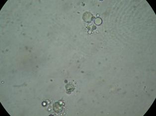 . Φωτογραφίες από μικροσκόπιο γαλακτωμάτων