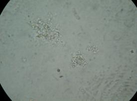 =33.7 Σχήμα.3. Φωτογραφίες από μικροσκόπιο γαλακτωμάτων