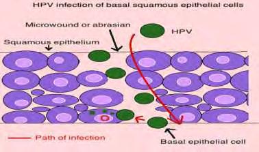 3. Ο κύκλος ζωής των HPV Γενικά οι HPVs δεν επάγουν τη λύση των κυττάρων και περαιτέρω μολύνσεις λαμβάνουν χώρα από διάχυση του ιού από τα ήδη μολυσμένα επιθηλιακά κύτταρα (Roden R.B. et. al., 2001).