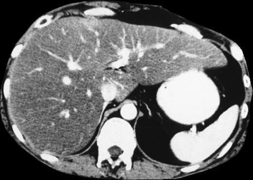 al. Gastroenterology. 2002;123:745-750.