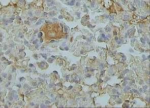 MMP-9 gelatinolytic activity of lun