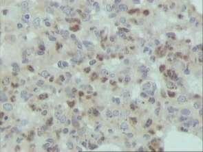 Representative figures of MMP-12 immunohistochemistry.