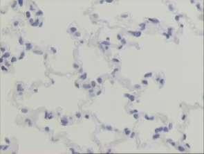 MMP12 is mainly located at alveolar macrophages and to