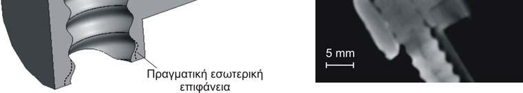 Όπως δείχνει η τοµογραφία, στο άνω µέρος του περικοχλίου, παρουσιάζεται µια κωνικότητα στο σπείρωµα, για να υποβοηθήσει την συναρµολόγηση και την σταδιακή εξοµάλυνση τραχυτήτων κατά το αρχικό χρονικό