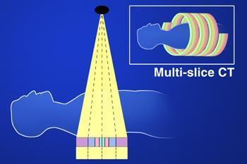 Αξονική τομογραφία (CT) Παλαιά τεχνολογία Σύγχρονη τεχνολογία 1 τομή σε κάθε περιστροφή της λυχνίας πολλαπλές τομές σε κάθε περιστροφή της λυχνίας