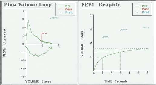 AVP: Λόγος αλβουμίνης πτυέλων/ορού F/V, FRC, DLCO