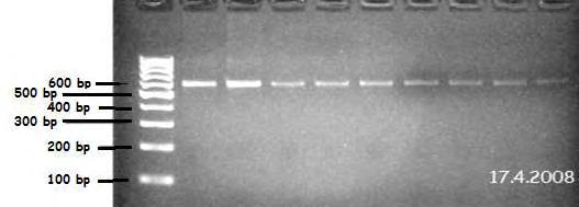 Π1. Χαρακτηριστικές εικόνες ηλεκτροφόρησης γονιδίων σε πήκτωμα αγαρόζης των υπό μελέτη μικροοργανισμών. Εικόνα 40.