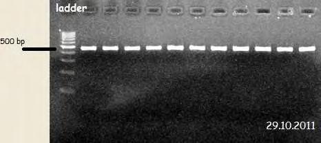Ηλεκτροφόρηση και των επτά διατηρημένων γονιδίων ενός στελέχους Enterococcus faecalis σε πήκτωμα αγαρόζης. Εικόνα 42.