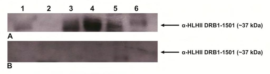 Αποτελέσματα Συζήτηση Σχήμα 52: Ανοσοαποτύπωση για ανίχνευση της HLA II DRB1-1501 πρωτεΐνης.