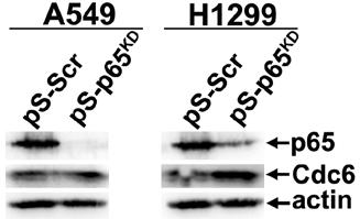 p53 και της β- ακτίνης ως μάρτυρα αναφοράς.