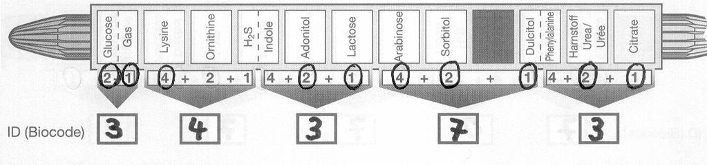 (A) (B) Εικόνα 6: Πίνακας αποτελεσµάτων του BBL Enterotube II (A= βάση δεδοµένων µε VP, B= βάση δεδοµένων χωρίς VP) Πίνακας 1: Εµφάνιση αρνητικών και θετικών αντιδράσεων µε το BBL Enterotube II ΑΝΤΙ