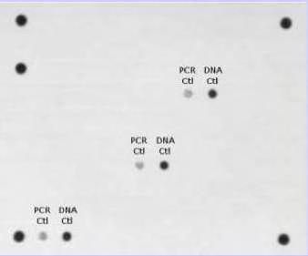 Κουκίδες ελέγχου ορθής στοίχισης του array tube (σωληνάριο που επιτελείται η ανίχνευση) Κουκίδες ελέγχου ορθής στοίχισης του array tube (σωληνάριο που επιτελείται η ανίχνευση) Εικόνα 4: Τυπική εικόνα