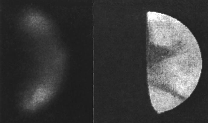 Στέλλας Ι. / Οπτική και ψηφιακή παρατήρηση της Αφροδίτης. Αυτός ο σχηματισμός φάνηκε καθαρά στον Richard Baum και λιγότερο στον Keith Reid.