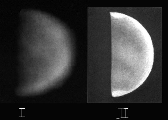 Στέλλας Ι. / Οπτική και ψηφιακή παρατήρηση της Αφροδίτης. Εικόνα 5. Ι) Η Αφροδίτη (13/1/2001) στο υπεριώδες από τον Frank Mellilo. ΙΙ) Οπτική παρατήρηση του Richard Mc Kim, 14/1/2001 16.10' U.