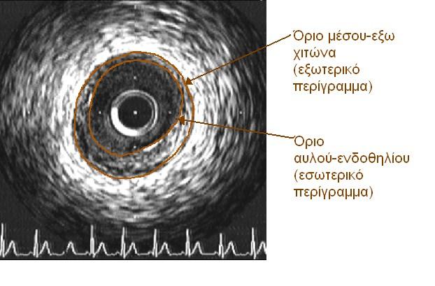 εικόνας 1.3.