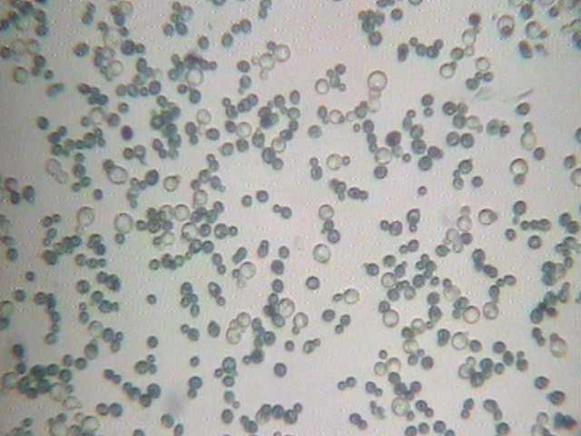 Saccharomyces