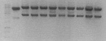 5.500 2.600 M 1 2 3 4 5 6 7 8 9 10 1 2 3 4 5 6 7 M pcdna3.1-flagc HIF-1 IA/SA 5.500 2.600 M 1 2 3 4 5 6 7 8 9 10 Ε 4.3: Φωτογραφίες από την πηκτή αγαρόζης.