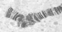 Εικόνα 30: Ένωση tips (βέλος) των πολυταινικών βραχιόνων 3R 5R σε δύο διαφορετικούς πολυταινικούς πυρήνες της C. fasciventris. 3.3 Εντοπισμός γονιδίων με in situ σε πολυταινικά χρωμοσώματα του είδους C.