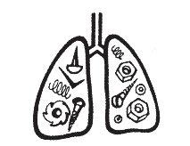 Pneumoconióticos Alteración pulmonar por partículas
