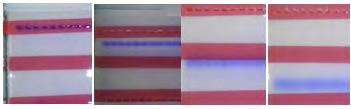 Εικόνα 16: Στάδια απομάκρυνσης ηλεκτροφόρηση. των χρωματισμένων ζωνών κατά την Εικόνα 17: Σύστημα ανάλυσης εικόνας MultiImage Light Cabinet της Alpha Innotech.