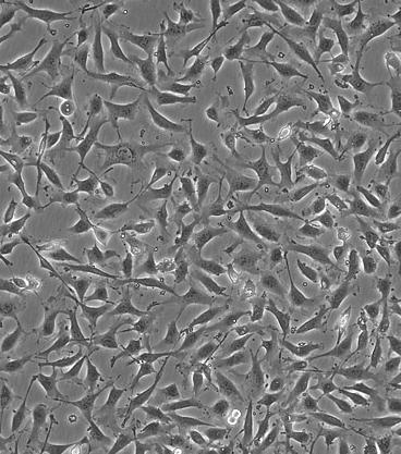 3.2.3. Καλλιέργεια της κυτταρικής σειράς EA.hy926 Στην παρούσα μελέτη χρησιμοποιήθηκε η κυτταρική σειρά EA.hy926 (ενδοθηλιακά κύτταρα ανθρώπου).