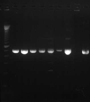 6000 Ανάκτηση DNA/ gr ιστού *, # mg DNA/gr tissue 5000 4000 3000 2000 1000 0 Pr1 Pr2 Pr3 Σχήμα 3. Η ανάκτηση του DNA ανά γραμμάριο ιστού, στο σύνολο των δειγμάτων, στα τρία εξεταζόμενα πρωτόκολλα.