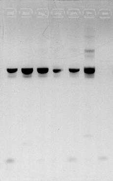 18S πανμυκητιακή PCR στήλη 1. 100 bp DNA ladder 2. Prot1, θετικό δείγμα για T. rubrum. 3. Prot2, 4. Prot3, 5. Prot1, θετικό δείγμα για C. tropicalis 6. Prot2, 7. Prot3. DNA: 13 μg/ml Εικόνα 2.