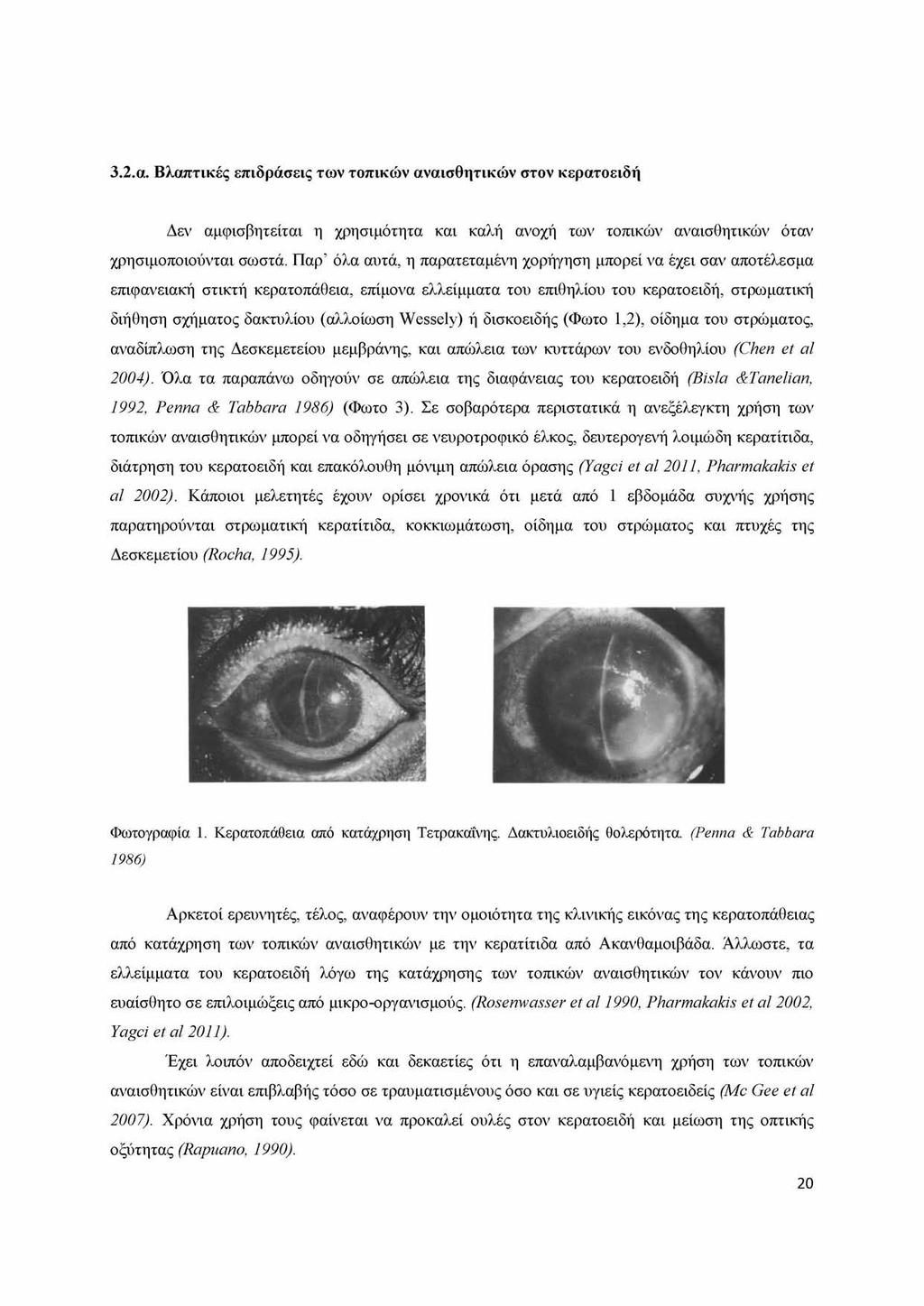 3.2.α. Βλαπτικές επιδράσεις των τοπικών αναισθητικών στον κερατοειδή Δεν αμφισβητείται η χρησιμότητα και καλή ανοχή των τοπικών αναισθητικών όταν χρησιμοποιούνται σωστά.