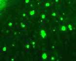 Nicastrin +/5XFAD (πάνω) και ένα CamKIIα icre Nicastrin -/-