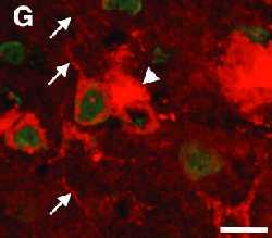 διαμερίσματα όπως τα ενδοσώματα (endosomes).