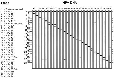 Εργαστηριακά αποτελέσματα ρουτίνας PCR-LiPA
