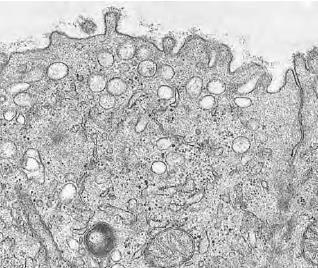 Mikroresice 1 µm dužine 5 /ćeliji