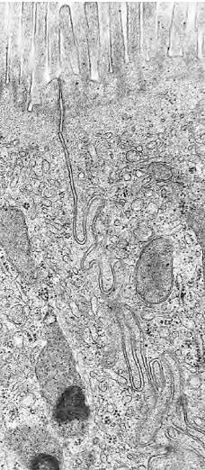 Macula adherens dezmozom Pukotinaste veze Morfološke