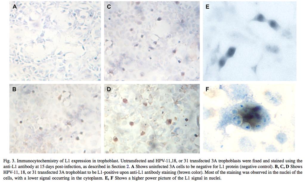 HPV 18 HPV 11 HPV 31 Αντίστοιχα με τον HPV 16, πλήρη αναπαραγωγικό κύκλο μπορούν να έχουν σε καλλιέργειες τροφοβλαστικών κυττάρων και άλλοι τύποι του HPV όπως ο 11, ο 18 και ο 31. Placenta.