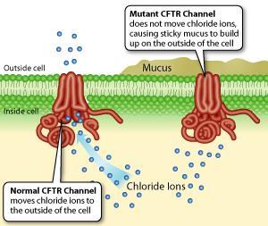 Κυστική ίνωση: Μεταλλαγμένη πρωτεΐνη