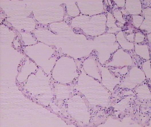 Εικόνα 8: Ελάχιστα μακροφάγα και λεμφοκύτταρα στο διάμεσο πνευμονικό χώρο της ομάδας 2 (βέλος).