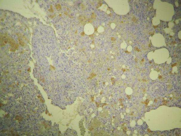 Εικόνα 42: Θετικά κύτταρα για τη Εικόνα 43: Θετικές μυϊκές ίνες σε χρώση i-nos στο διάμεσο χώρο τοίχωμα