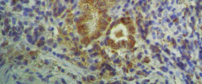 Έκφραση του ενζύμου στα και στα καλυκοειδή κύτταρα