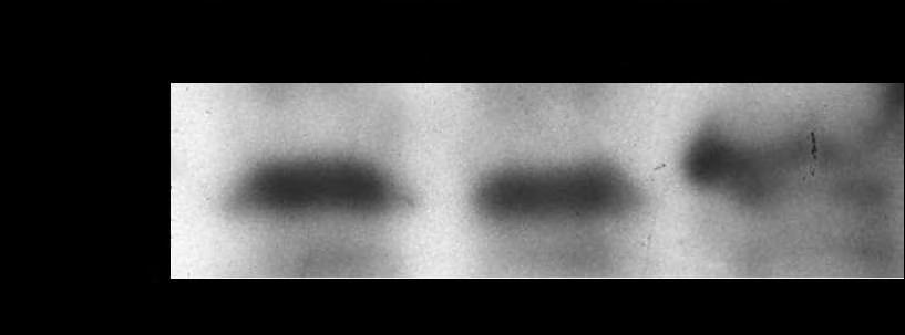 34 Εικόνα 12: Western blot σε δείγματα διαφορετικών συγκεντρώσεων από ολικό εκχύλισμα NCI-H520 κυττάρων. Φαίνονται οι ζώνες της PARN στα 74kDa. 3.