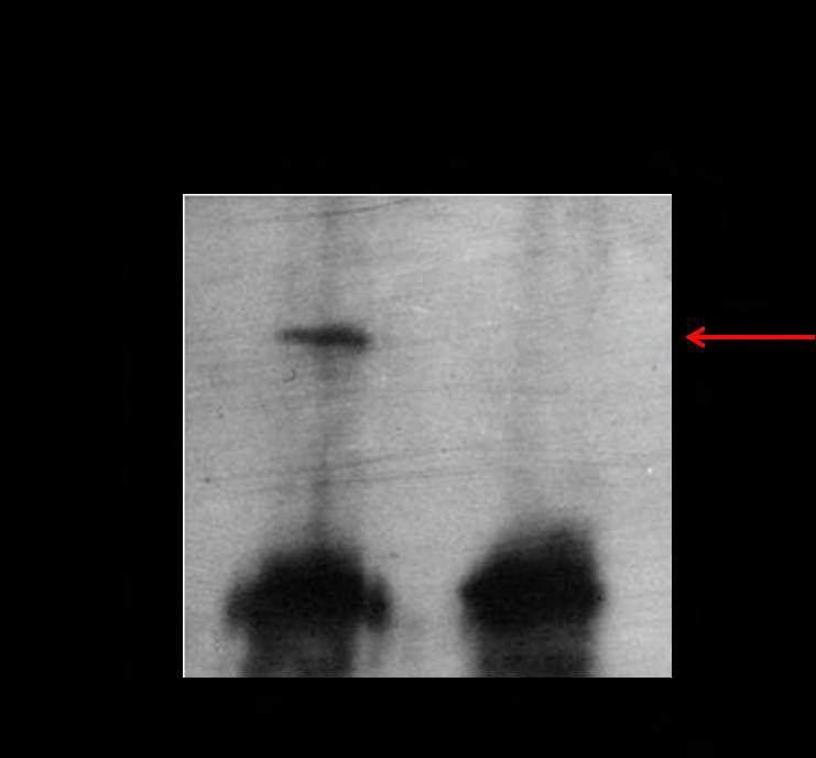 35 Εικόνα 13: Western blot στο δείγμα Anti-PARN74-R(+) και Pre-immune-R(+) μετά από ανοσοκατακρήμνιση με το αντίσωμα anti-parn74. Η ζώνη της PARN ε- πισημαίνεται με κόκκινο βέλος. 3.