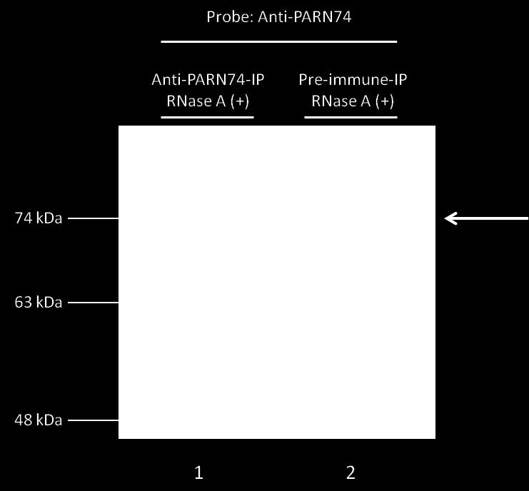 75cm 2 (~18 x 10 6 κύτταρα για το κάθε δείγμα-3 φλάσκες) και ακολούθησε η ίδια διαδικασία όπως περιγράφεται στη παράγραφο 3.