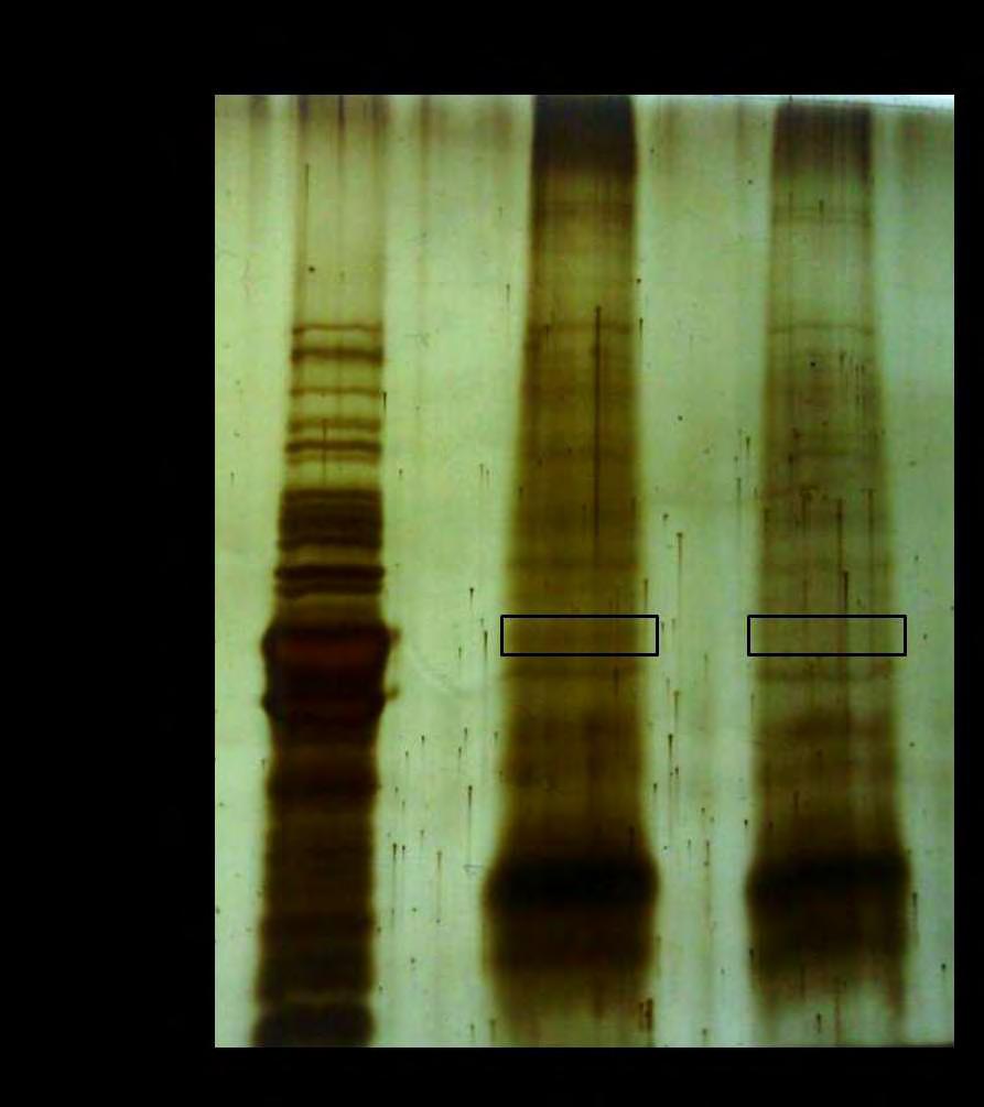 36 Εικόνα 11: Silver stain για τα δείγματα Anti-PARN74-R(+) και Pre-immune-R(+) μετά από ανοσοκατακρήμνιση. Απεικονίζεται και ένα δείγμα της PARN μετά από τον καθαρισμό της.
