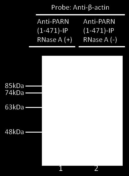 38 Εικόνα 13: Western blot στα δείγματα Anti-PARN(1-471)-R(-) και Anti-PARN(1-471)-R(+) μετά από ανοσοκατακρήμνιση με το αντίσωμα anti-β-actin.